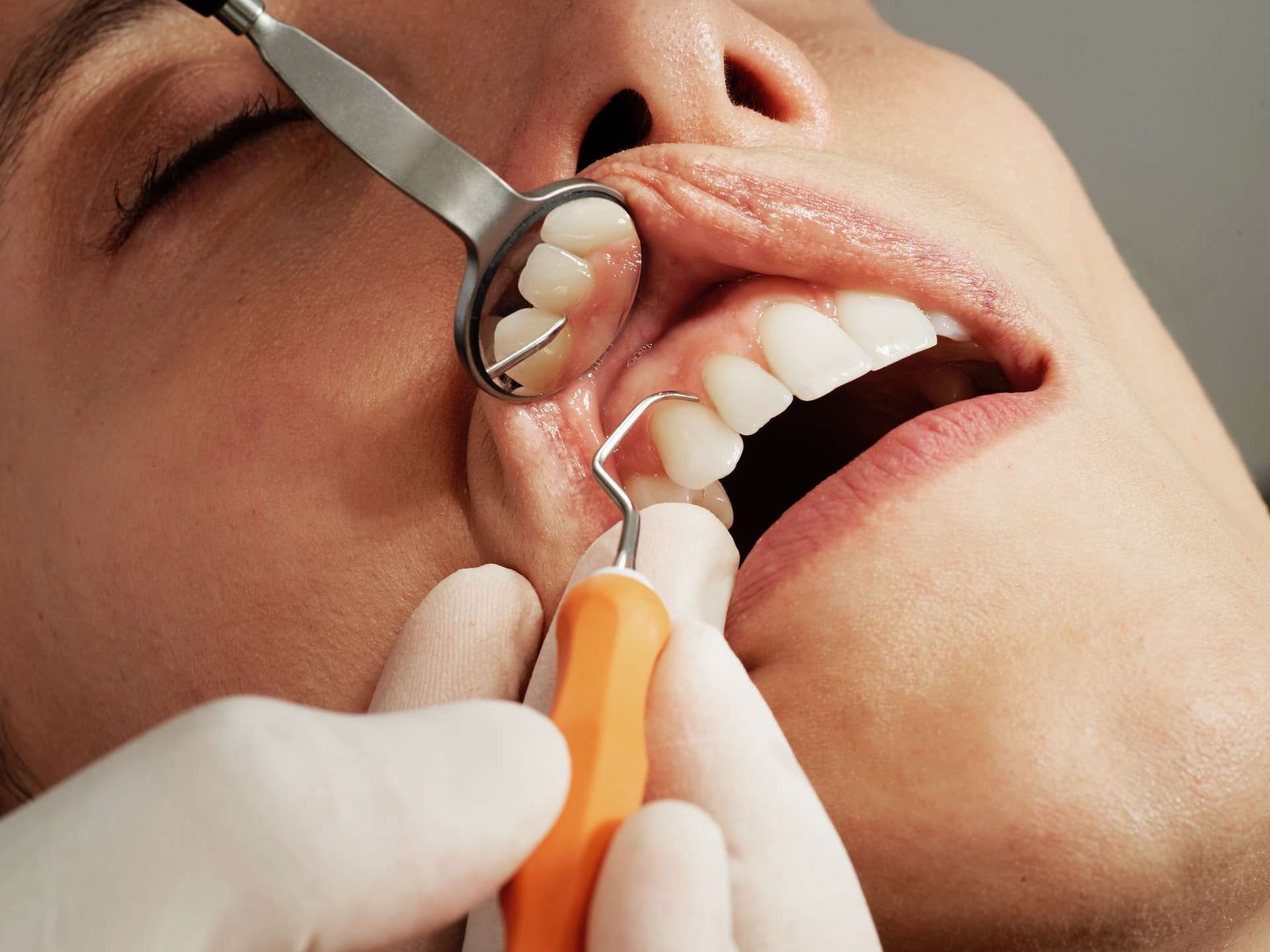 zabiegi stomatologiczne, dentysta