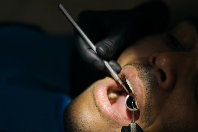 Jakie są rodzaje implantów zębów?